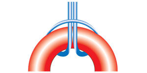 Lark's head knot on a donut component